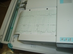 Graph of my heart beat and Mummy's contractions